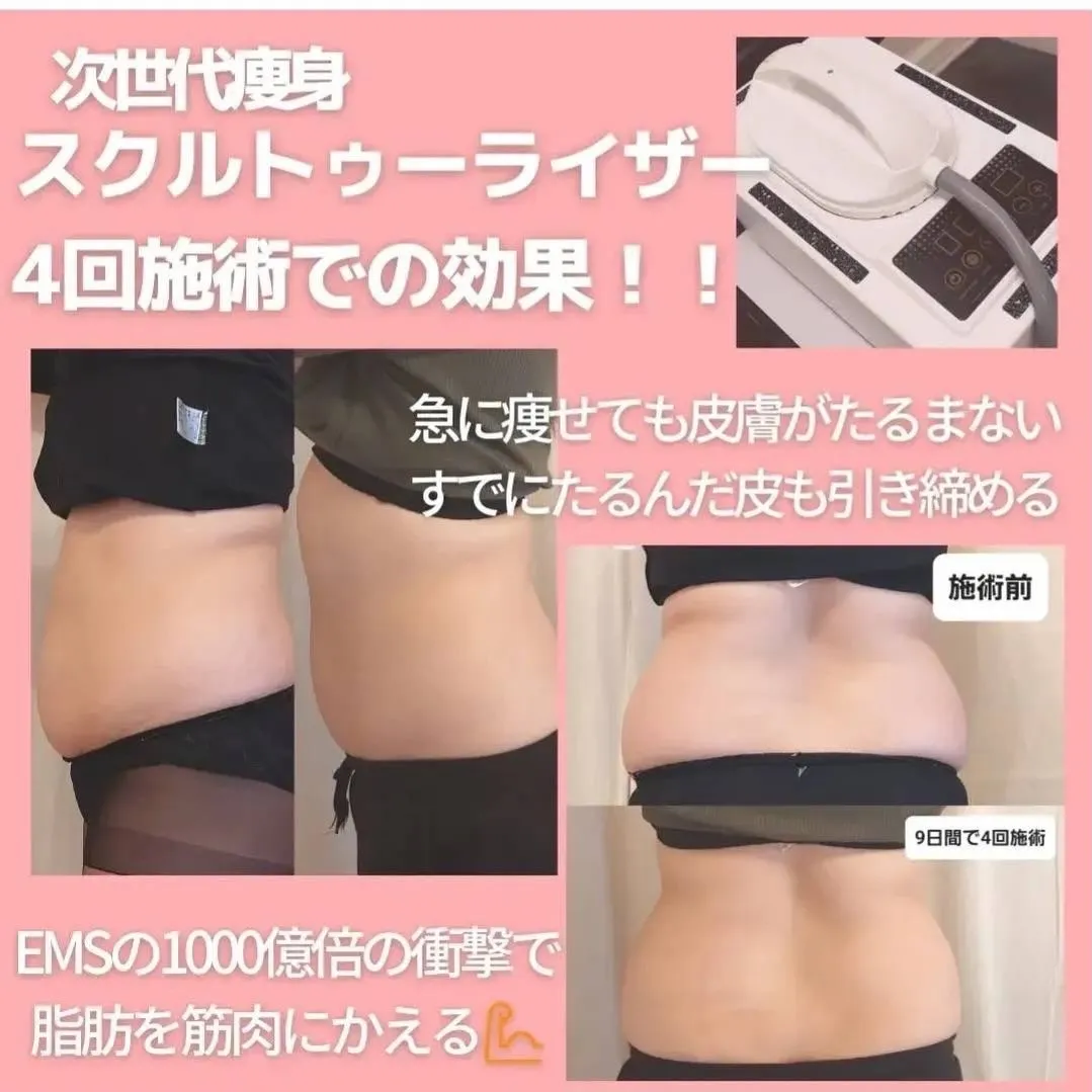 気になる部分、ピンポイントで引き締めたい方へ✨